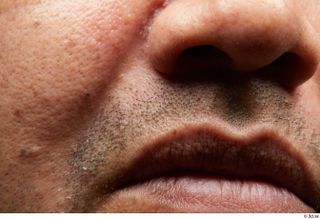 HD face Skin Ian Espinar cheek face lips mouth nose…